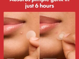 Hydrocolloid Acne Pimple Patch